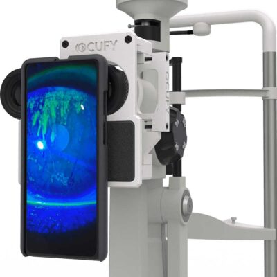 OCUFY® System | Mobile Phone Slit Lamp Adapter