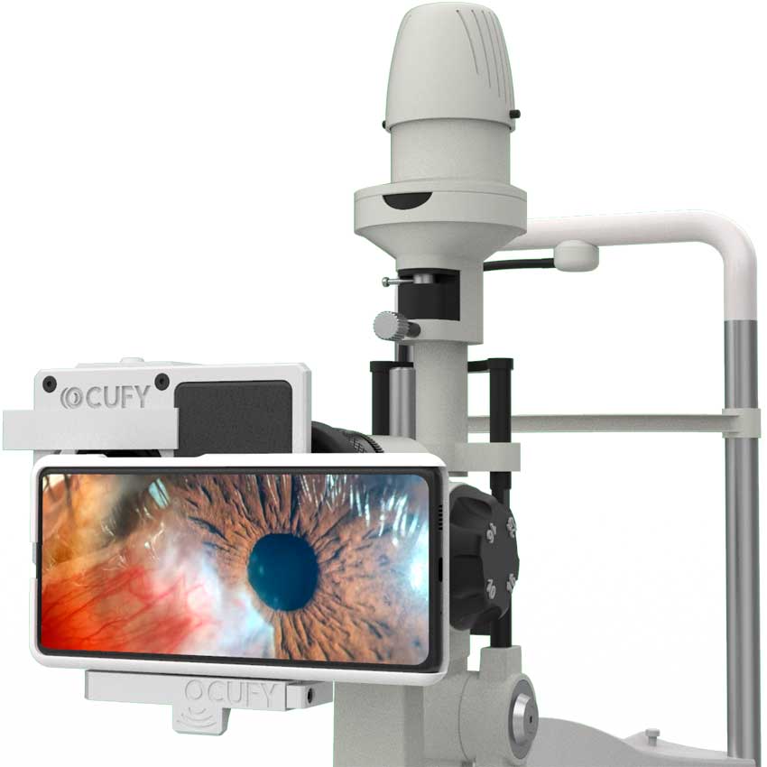 New OCUFY® Wide - Landscape Mobile Phone Slit Lamp Adapter